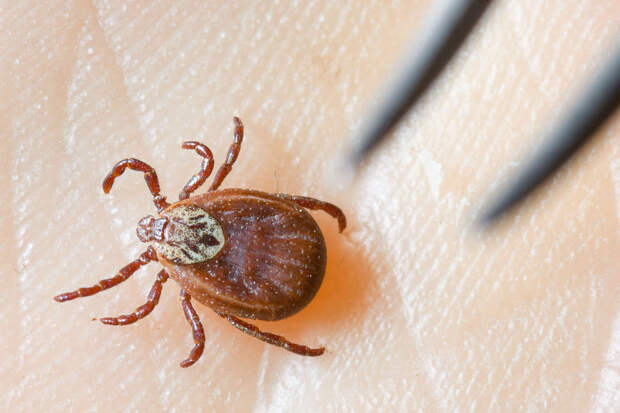 Врач Матюхин: клеща нельзя прижигать и резко извлекать из раны