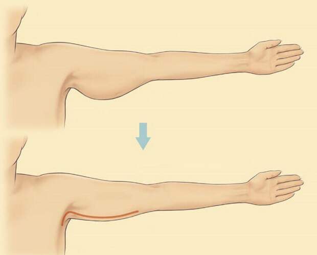 6 упражнений, которые помогут быстро подтянуть кожу на руках