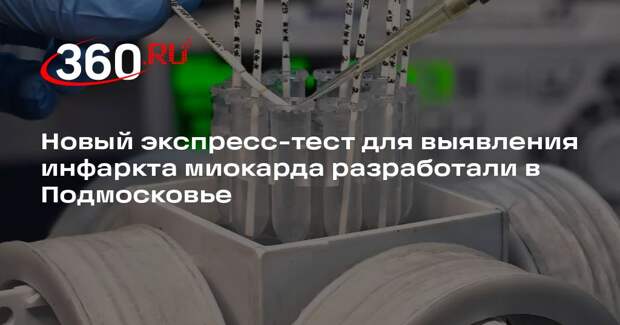 Новый экспресс-тест для выявления инфаркта миокарда разработали в Подмосковье