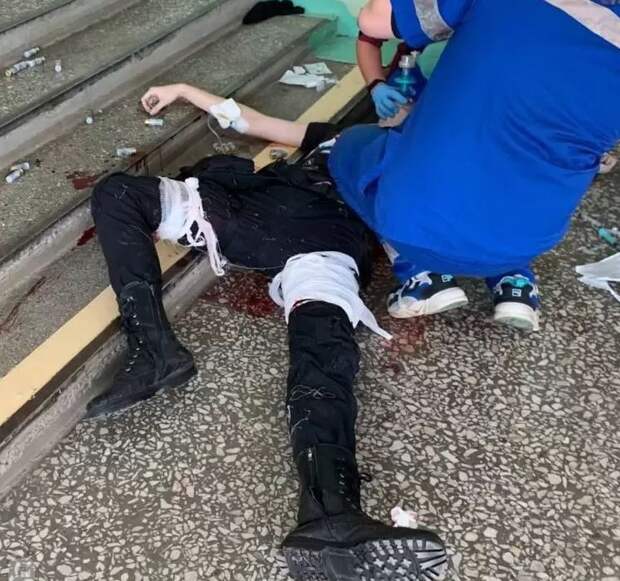 Стрелявший в вузе в Перми задержан и в тяжёлом состоянии находится в больнице