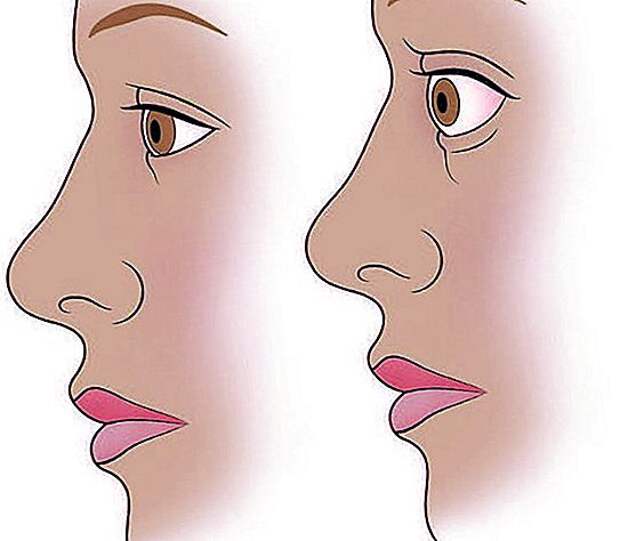Щитовидная железа и здоровье глаз: в чём связь?