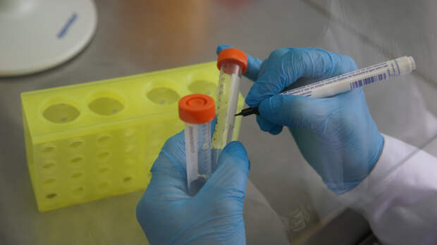 Более 60 детей заболели корью в Лондоне