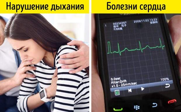 Как неправильный прикус влияет на самочувствие и внешность