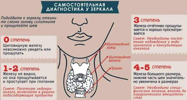 Узлы в щитовидке: что скрывается под термином «узел», как распознать заболевания и лечить. Йододефицит и его последствия