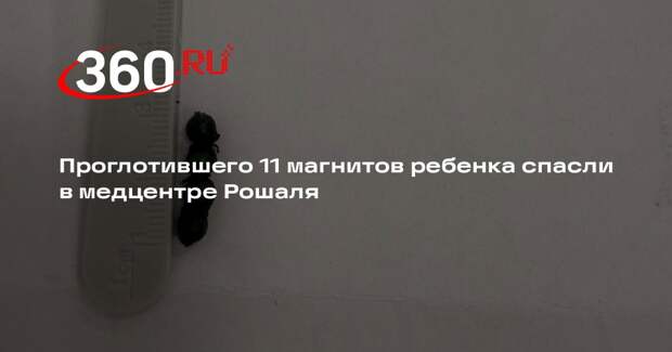Проглотившего 11 магнитов ребенка спасли в медцентре Рошаля