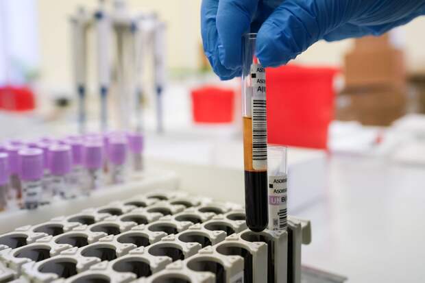 В пробе российского акробата Кузьмина обнаружили допинг