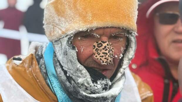 Алексей Смертин отморозил палец на ноге во время 50‑километрового забега в Якутии