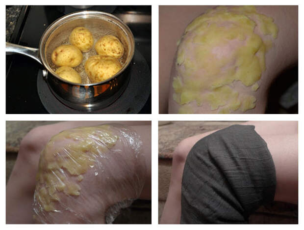 применение картофеля для прогревания сустава