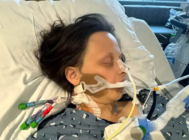 LADBible: американка заразилась ботулизмом, съев блюдо из рыбы