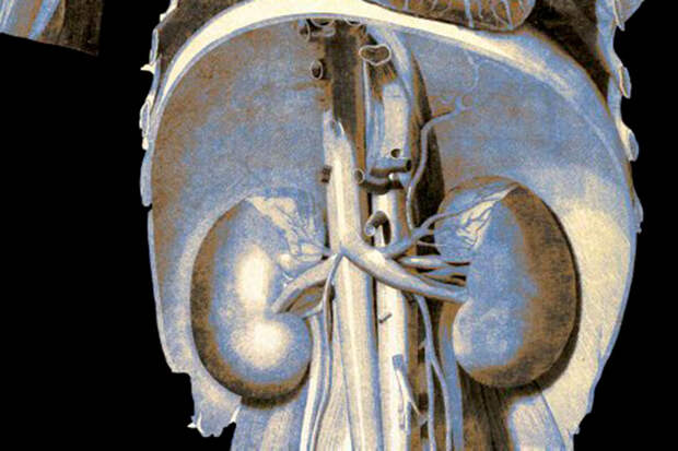 KidInt: препараты для лечения диабета могут замедлить старение почек