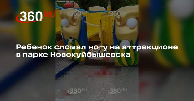 Мать сломавшего ногу ребенка на карусели в Новокуйбышевске: отходит от шока