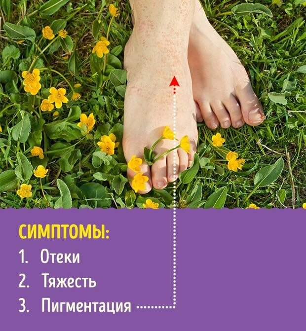 Что расскажут о здоровье ваши ноги