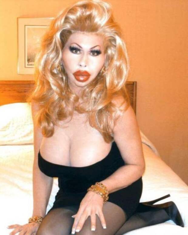 Перебор с силиконом (20 фото)