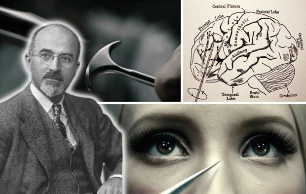 Позорная веха в истории медицины