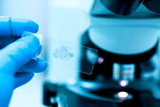 Nature: особый тип пластичных клеток HPCS помогает раку ускользать от лечения