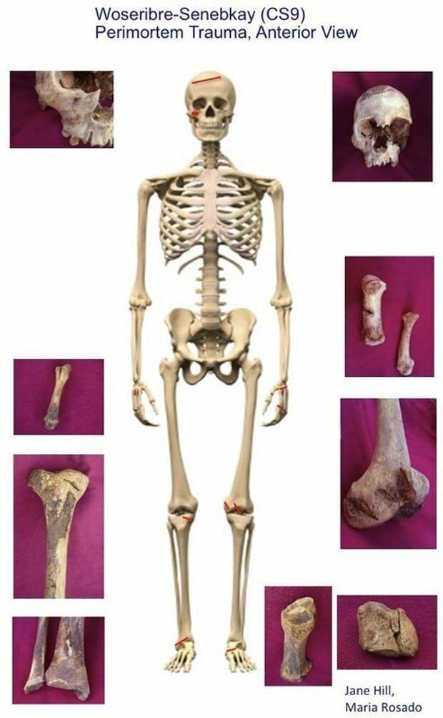 Скелет Сенебкея спереди, красным отмечены следы ударов, по бокам кости со следами ран. археология, древний египет, интересно, история, наука