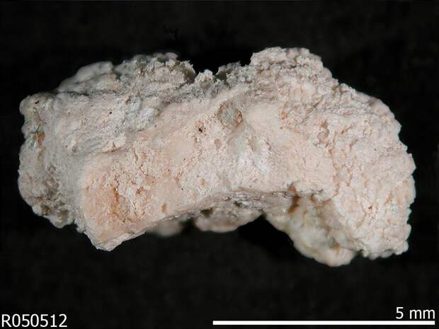 Hydroxyapatite