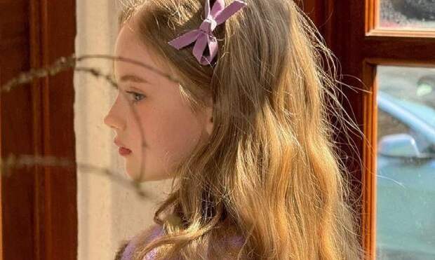 Как сейчас выглядит девочка Варя из Калужской области, которой в 10 лет прооперировали нос