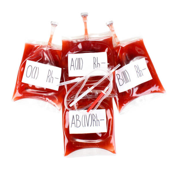 New research suggests that people with blood type AB may be more likely to develop memory loss in later years than people with other blood types.