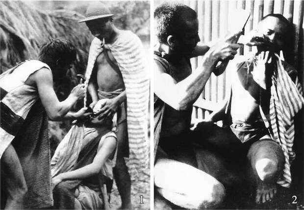 Этим людям в детстве удалили здоровые зубы…