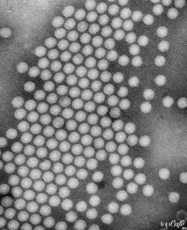 10 вирусов из пробирки: Полиомиелит. CC0