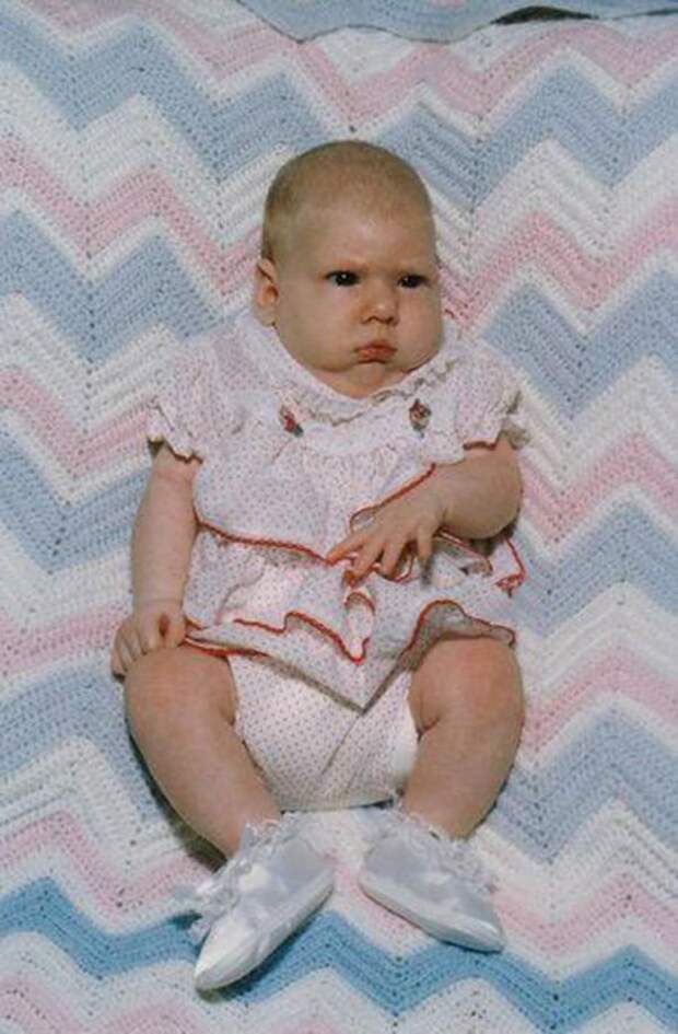 WorstBabyPhotos11 Эти ужасные младенцы