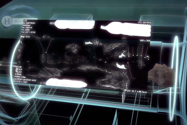 причины смерти