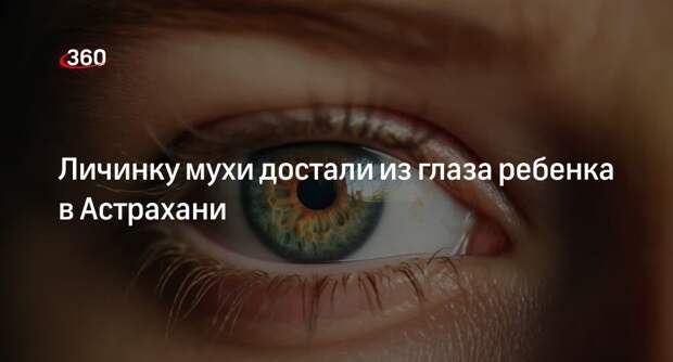 Личинку мухи достали из глаза ребенка в Астрахани