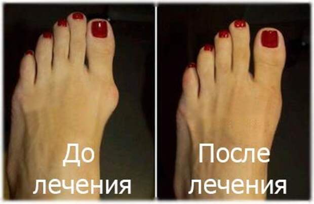 vOcOQ9hLYro