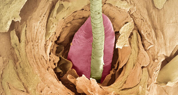 Microscopic skin mites like this one (pink tail of mite shown in a hair follicle in a false-color scanning electron micrograph) live on the face of every adult human on the planet, a new study suggests.