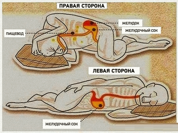 Картинки по запросу на какой стороне вы спите